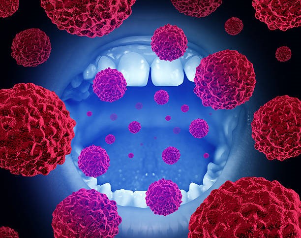 best cheek cancer in bihar jharkhand bengal orissa